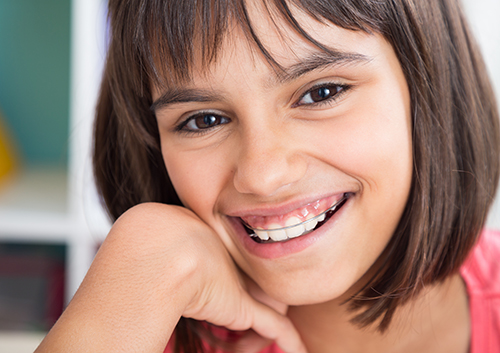 Braces-Friendly School Lunches