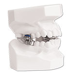 jaw surgery