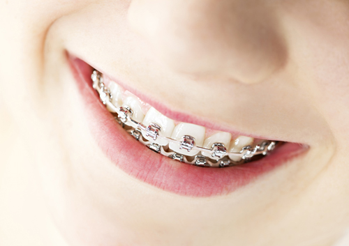 Orthodontics and Whole Body Health